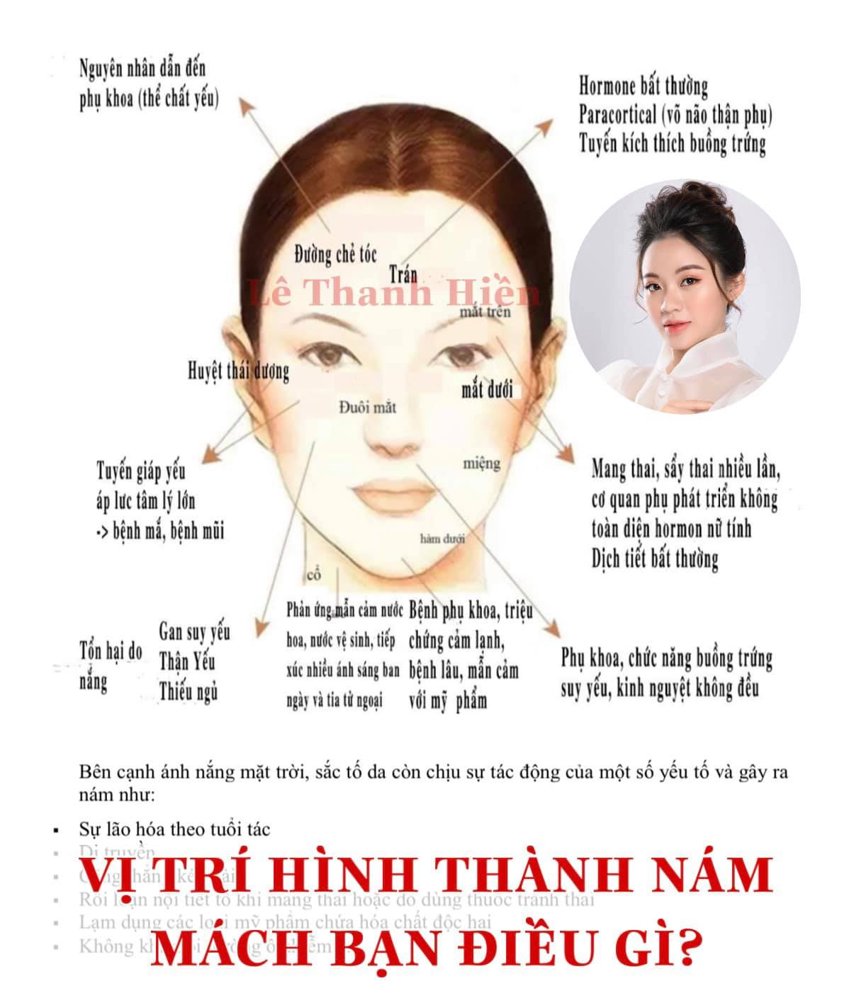 Vị trí hình thành Nám